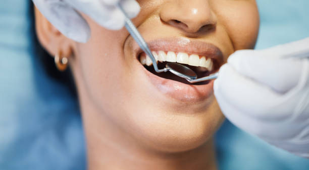 Best Knocked-Out Tooth Emergency  in Douglas, WY