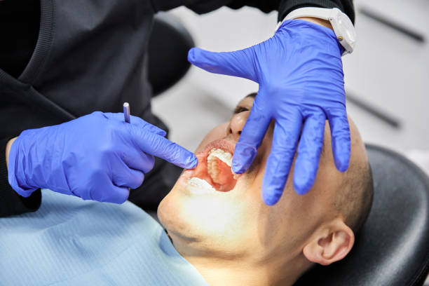 Best Dentist for Tooth Abscess  in Douglas, WY